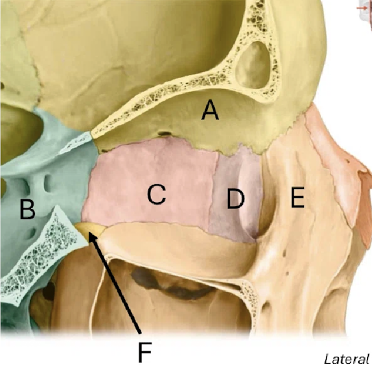 term image