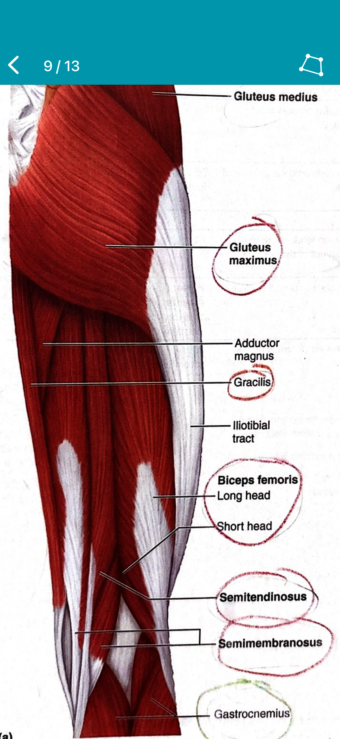<p>Biceps femoris </p>