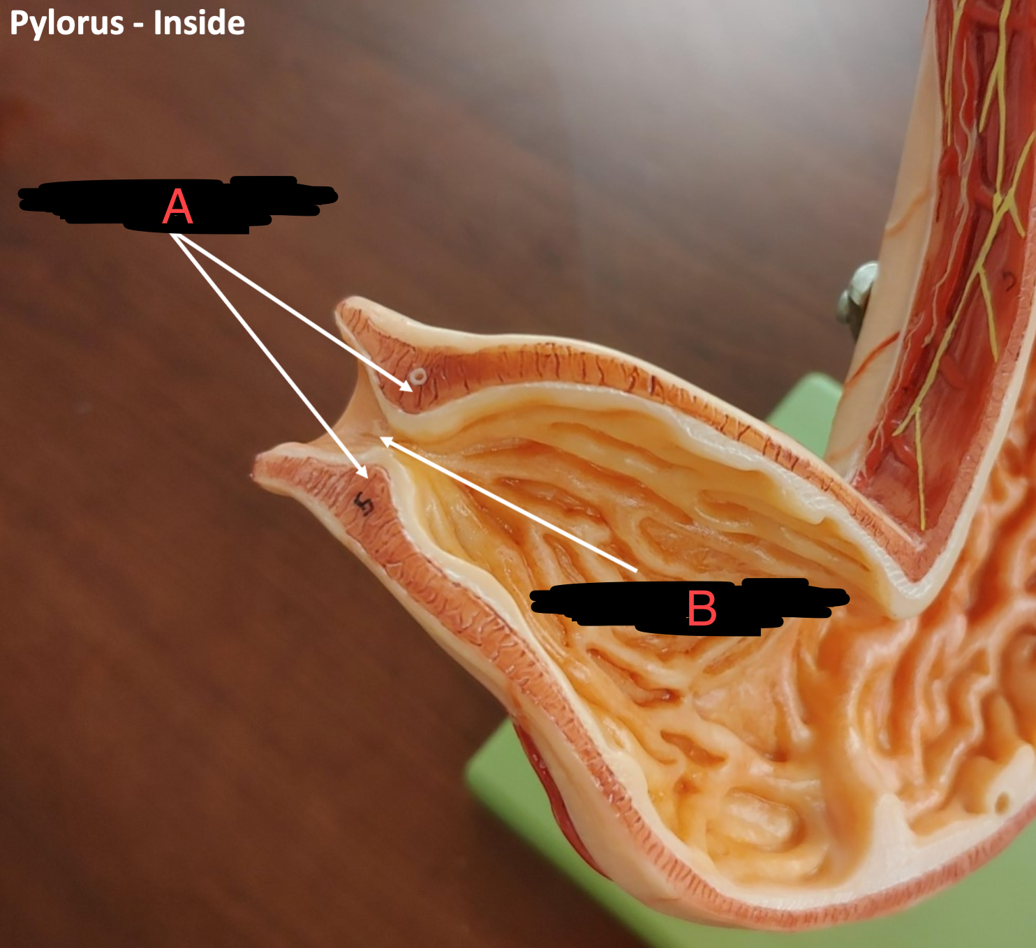 <p>what’s labeled</p>