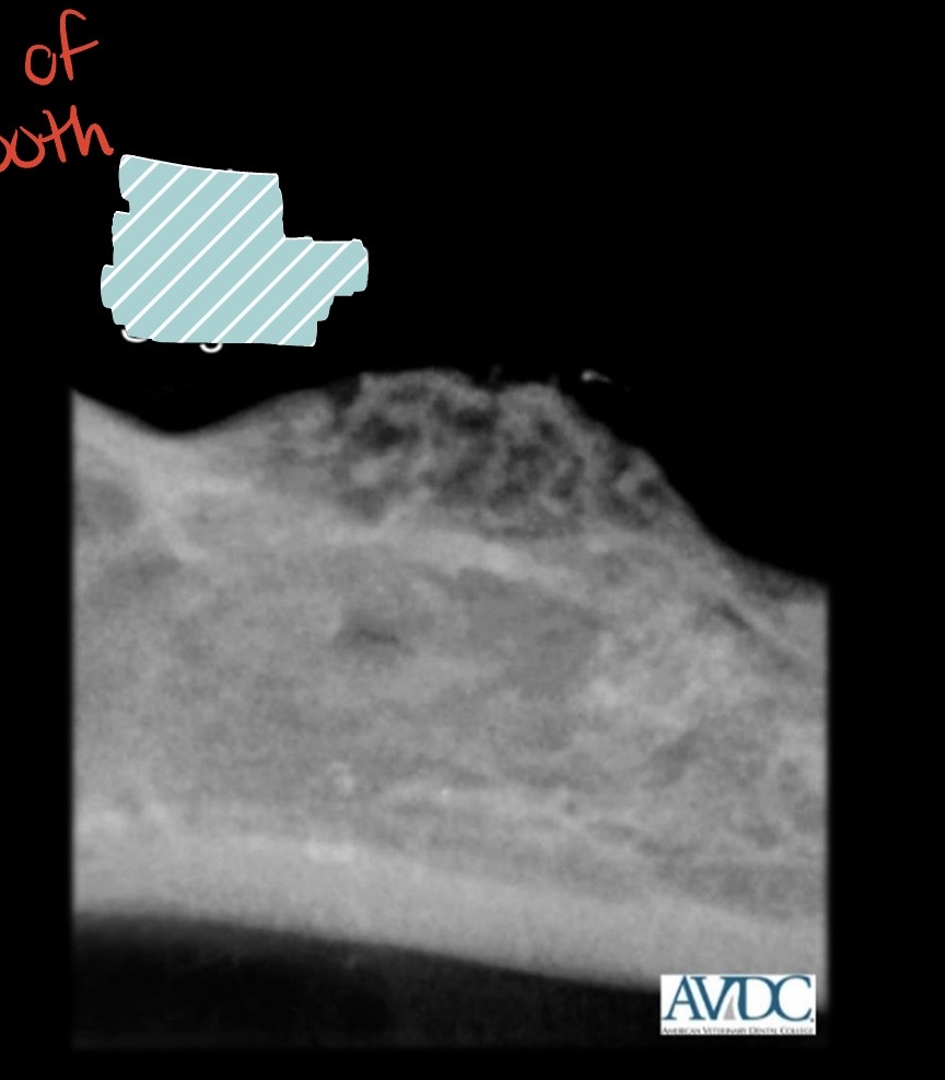 <p>what stage of tooth resorption is this?</p>