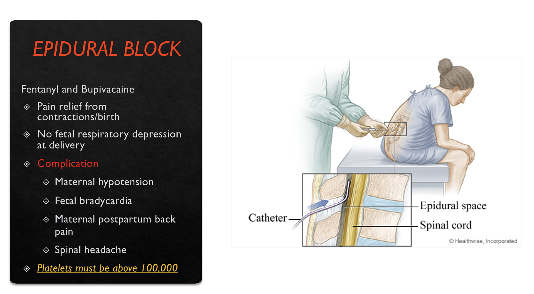 <p>EPIDURAL BLOCK</p>