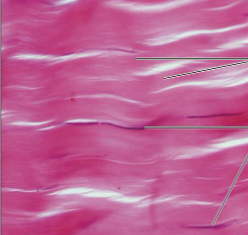 <p>what kind of tissue is this</p>