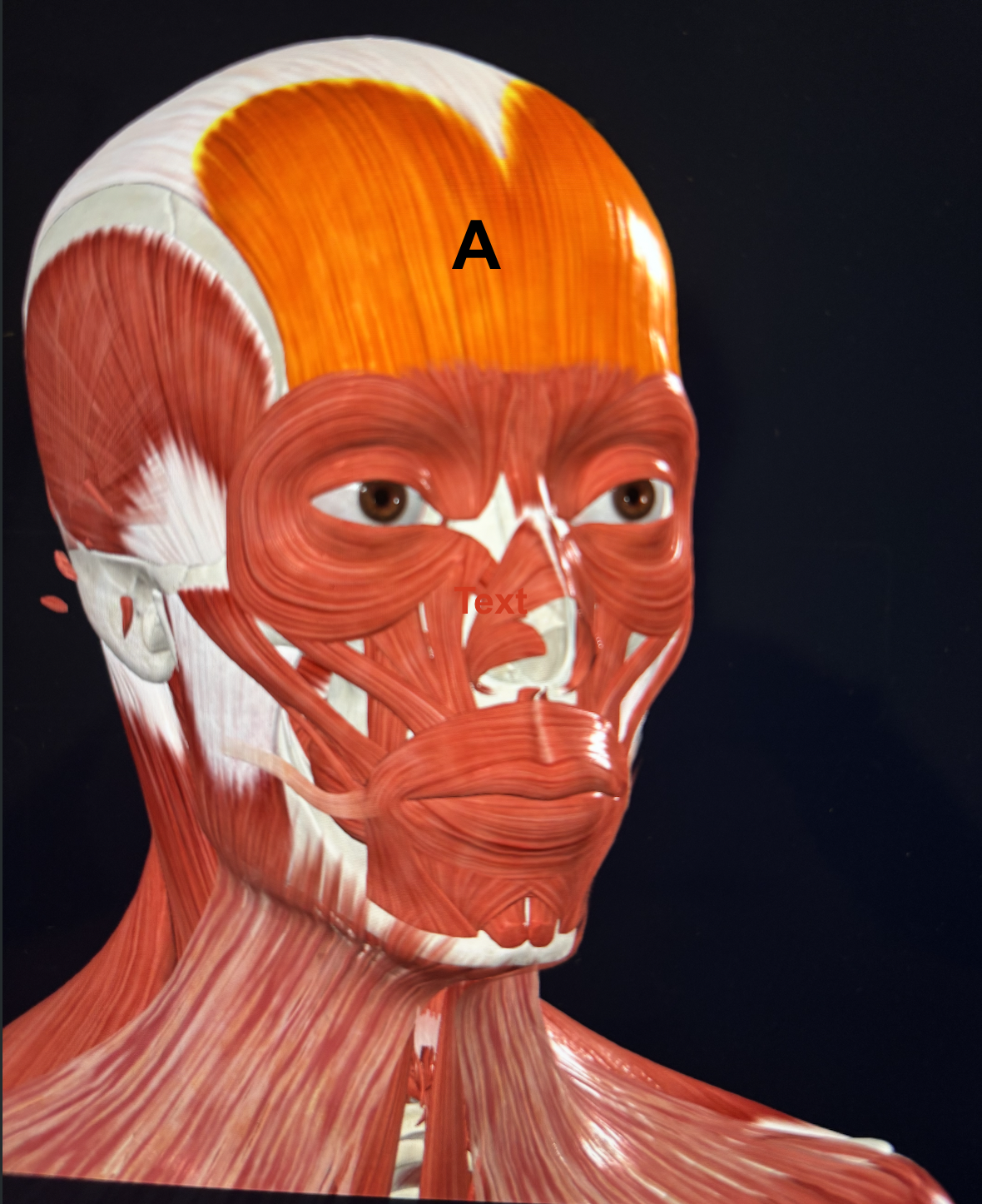 <p>A</p>