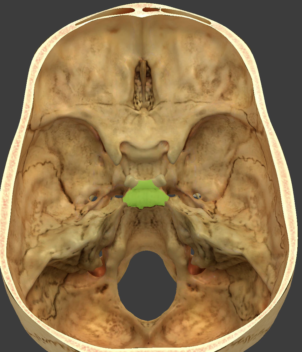 term image
