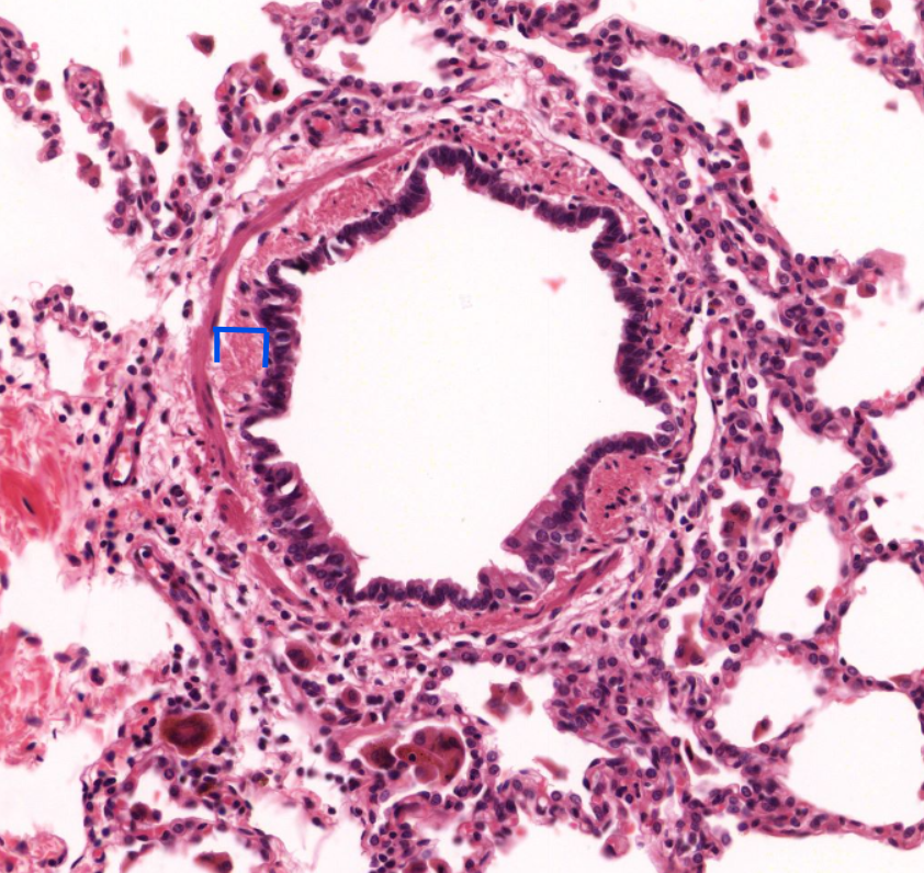 <p>identify the layer of mucosa </p>