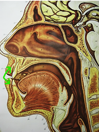 term image