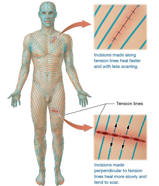 <p>Skin Markings</p>