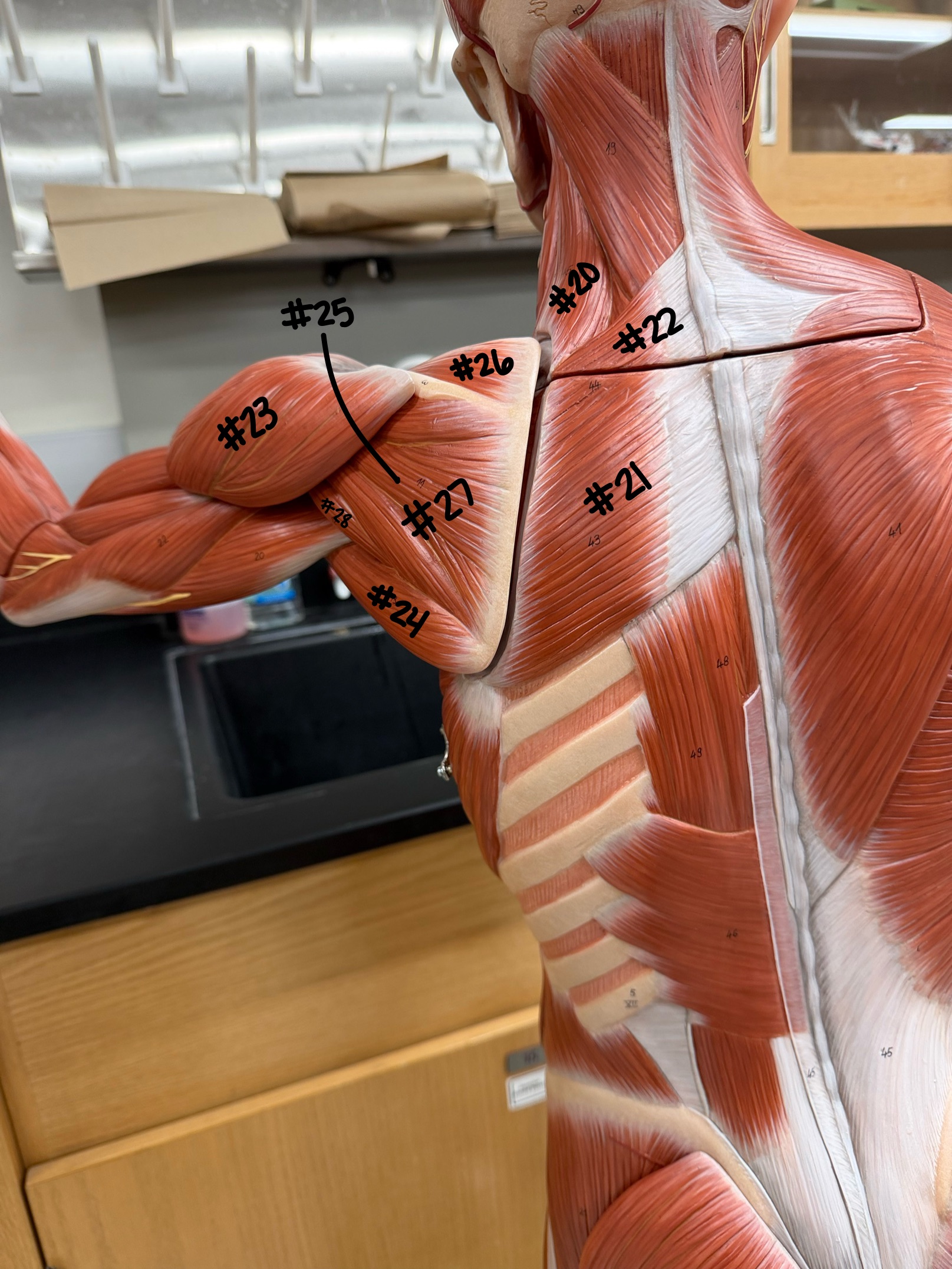 <p>What muscle of the rotator cuff is labeled #26?</p>