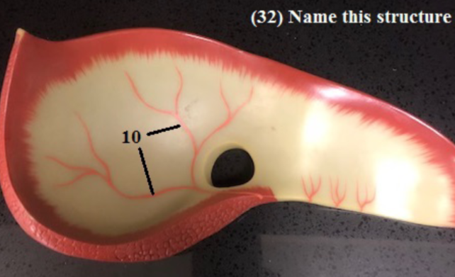 <p>Name this structure and label 10</p>