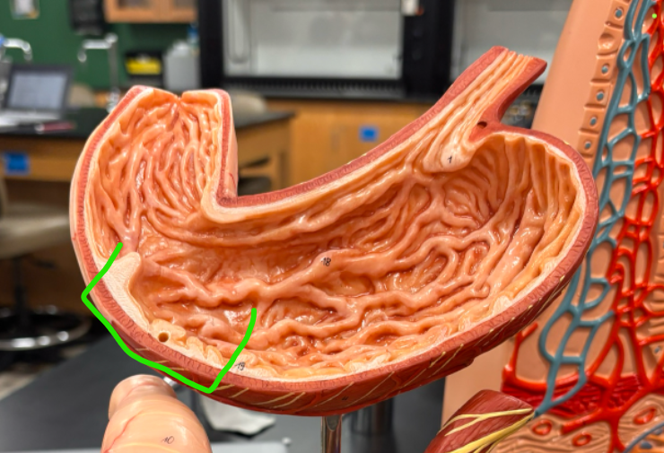 <p>What is the arrow pointing at?</p>