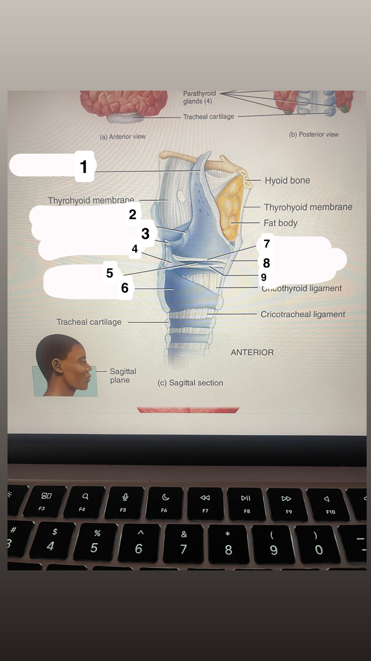<p>identify #5</p>