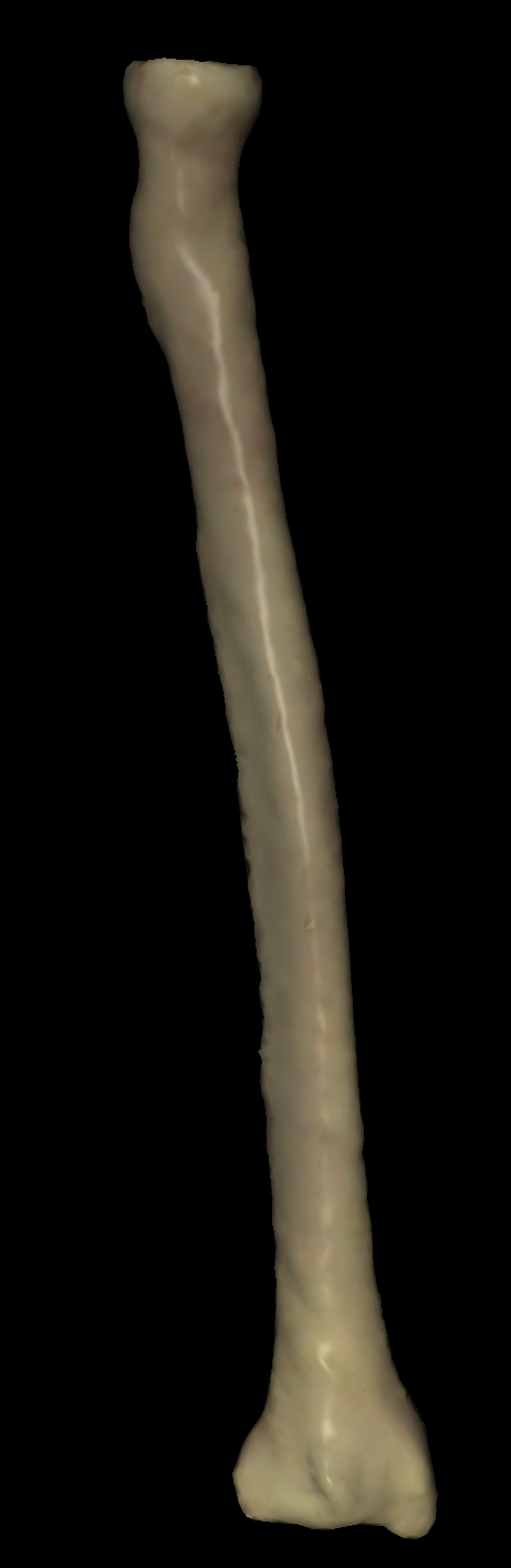 <p>Left or right radius?</p>