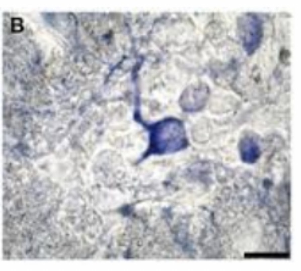 <p>Bipolar Neuron : Function : Carries sensory impulses for special senses like vision, smell, and hearing.</p>