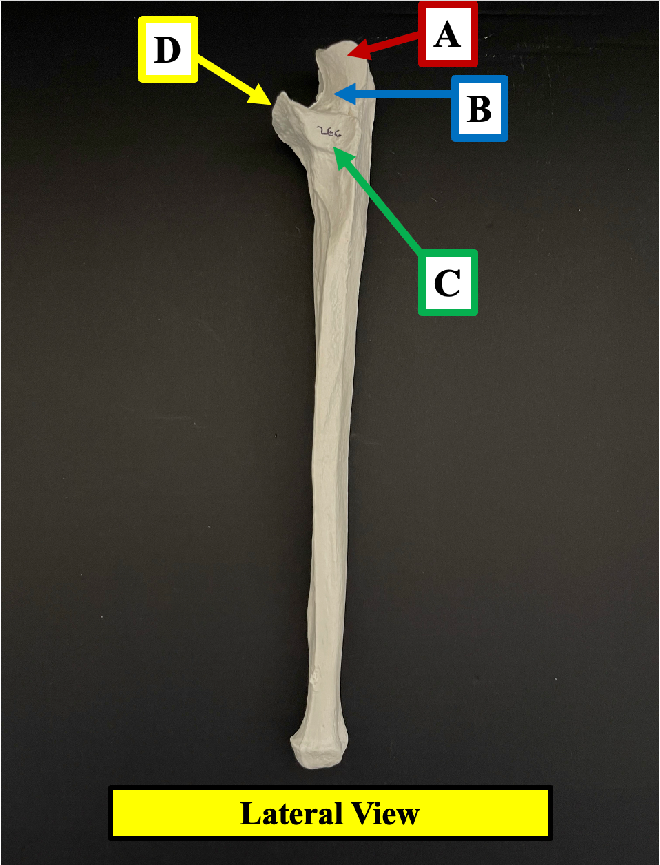 <p>Identify the bony landmark of the ulna that label <strong>A </strong>is pointing to.</p>