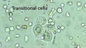 <p>Transitional Epithelial Cells</p>