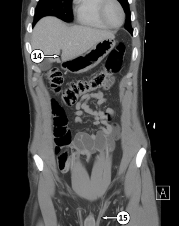 <p>Please label 14 and what is it’s function</p>