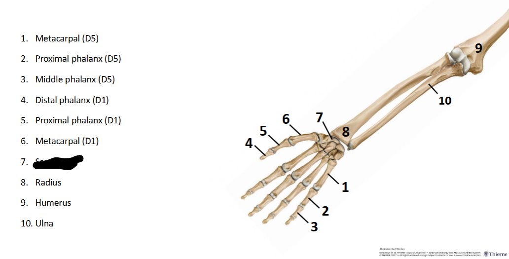 <p>What sturcture is this within the <strong>Upper-Appendicular?</strong></p>