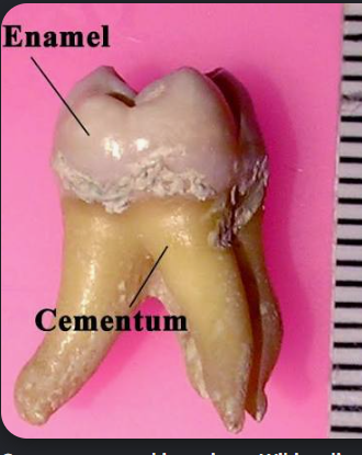 <p>enamal, cementum, dentin, pulp</p><p>pulp is the only soft tissue, the others are hard</p>