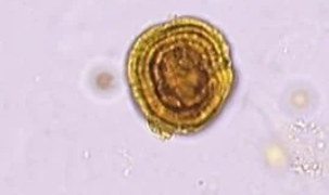 <p>what crystal; acidic or alk?</p>