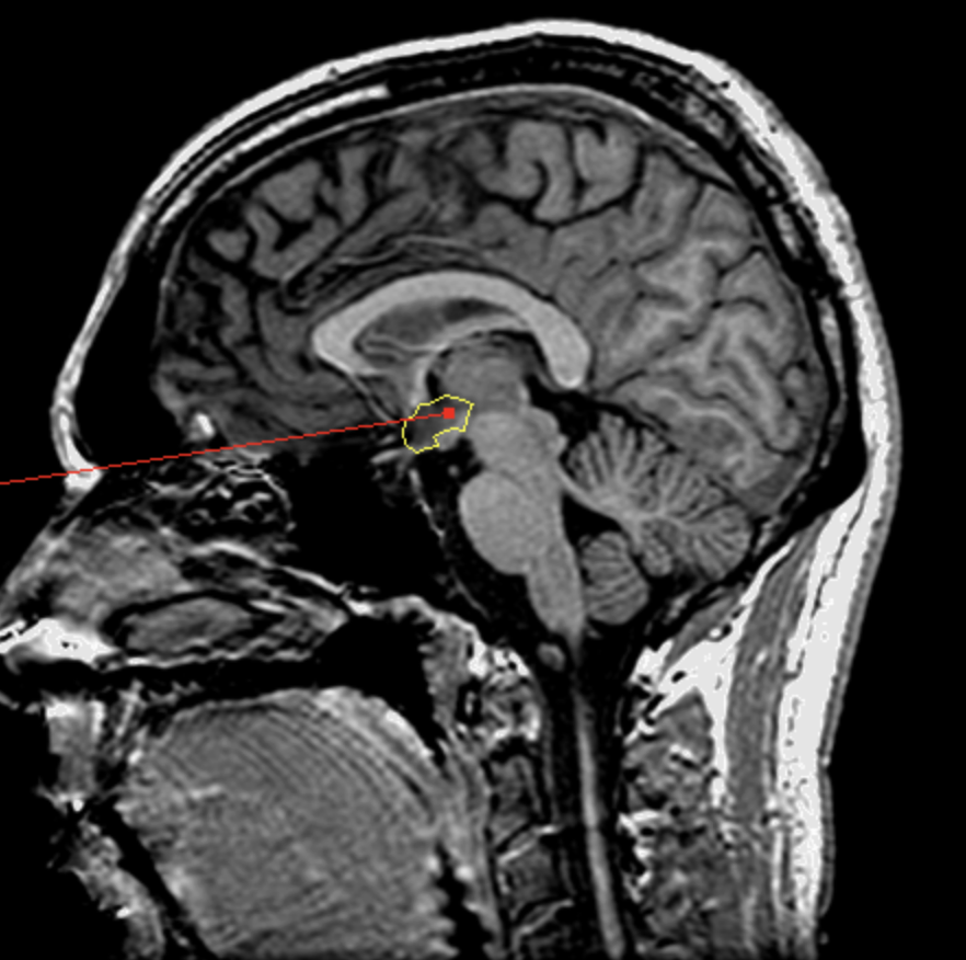 <p>What is the area highlighted called?</p>