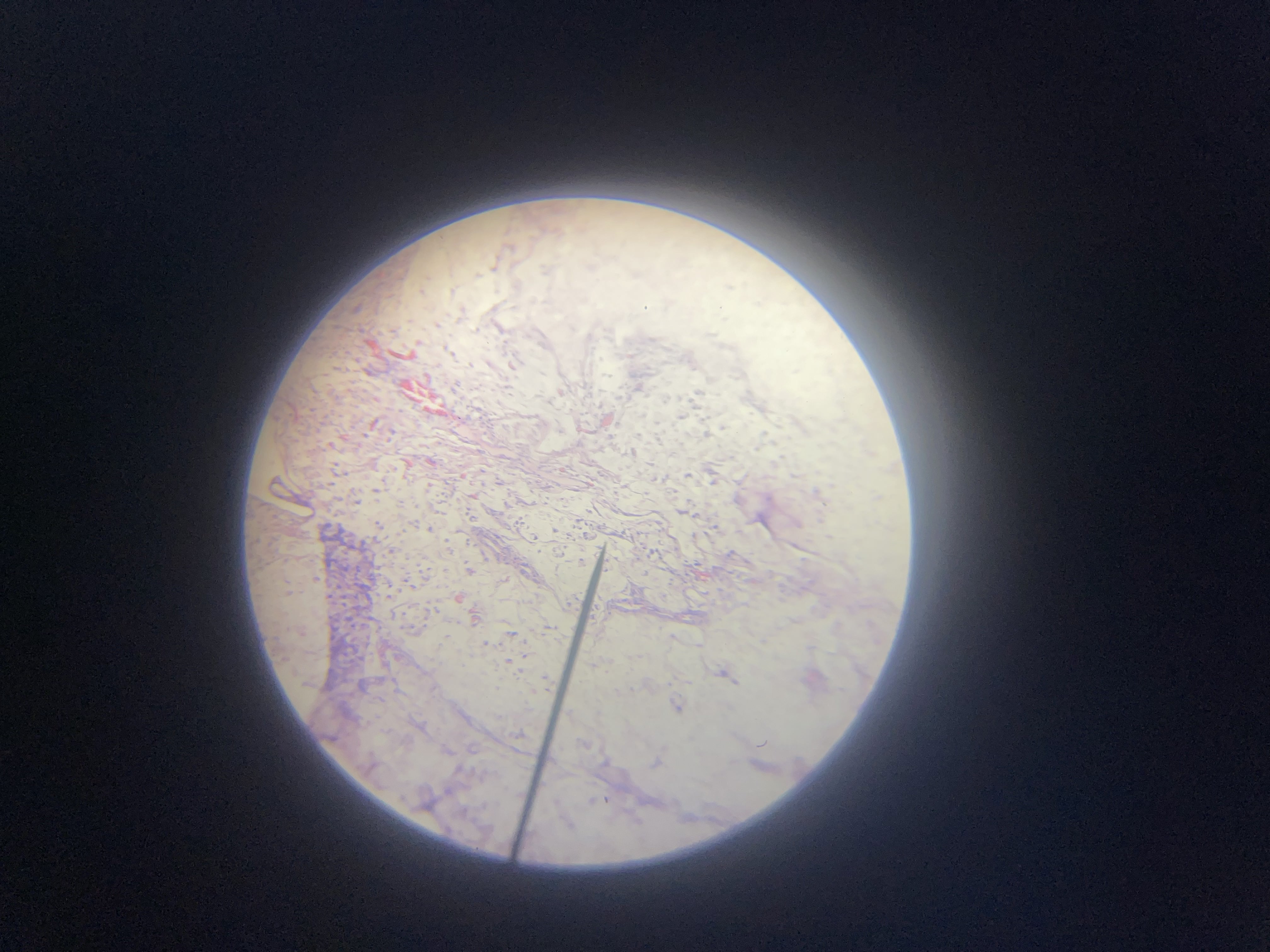 <p>What is the diagnosis?</p>