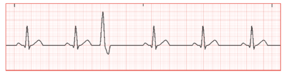 <p>Identify the heart rhythm on ECG strip</p>
