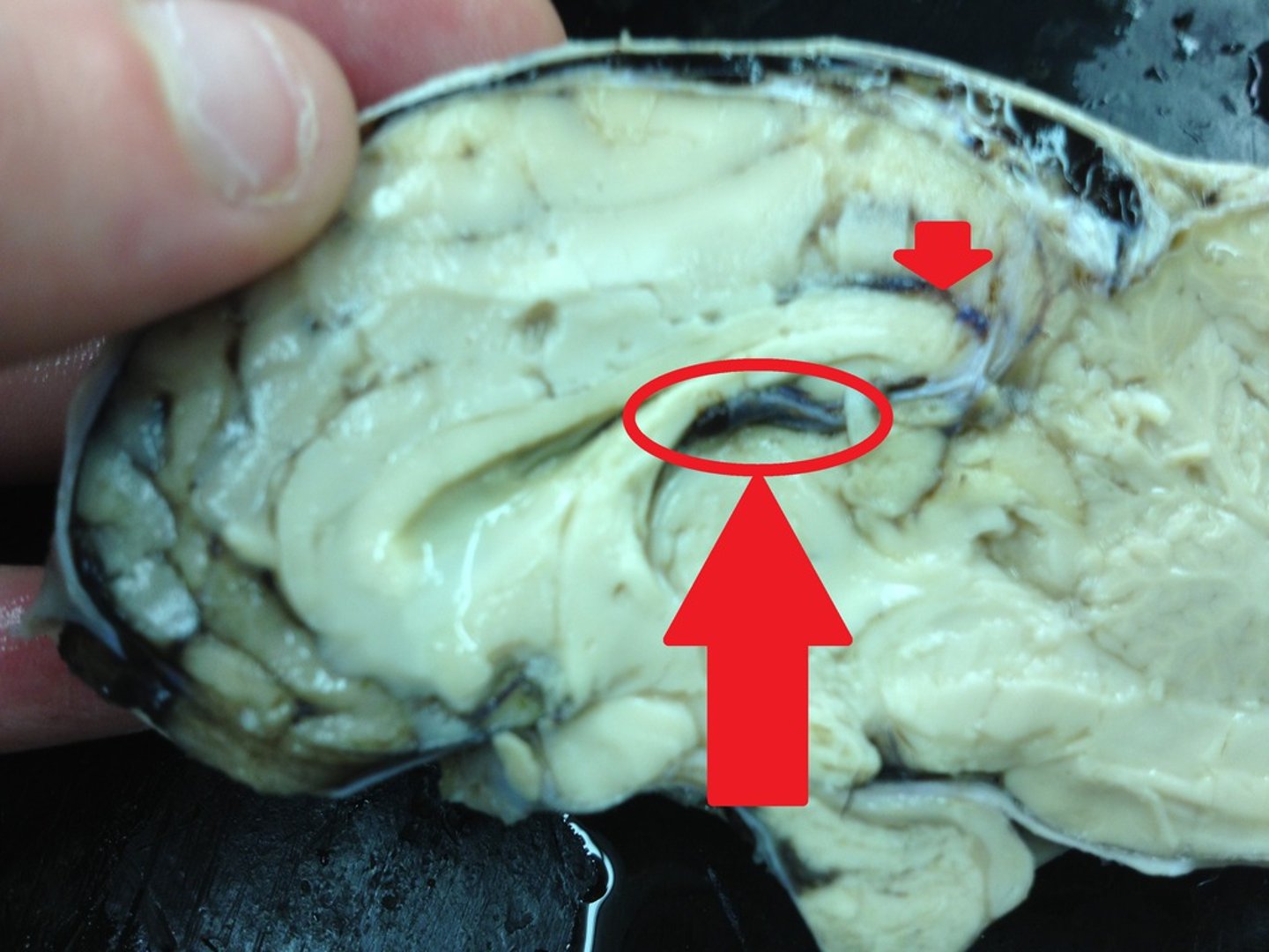 <p>-diencephalon</p><p>-inferior/dorsal/caudal to corpus callosum</p>