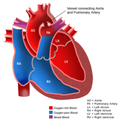 <p>foetal artery that connects aorta to pulmonary artery. blood detours away from lungs before birth</p>