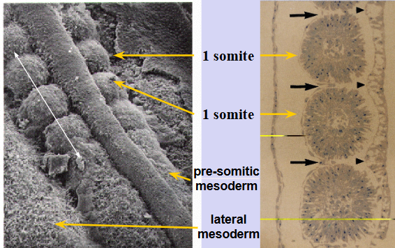 <p><span style="background-color: transparent;">segmented stereotypical paraxial mesoderm tissues, earliest evidence of segmentation in vertebrates </span></p>