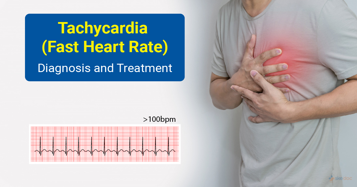 <p><span style="line-height: 107%;"><strong>BOOK:</strong></span></p><p class="MsoNormal"><span>No book</span></p><p class="MsoNormal"><span style="line-height: 107%;"><strong>SIMPLE:</strong></span></p><p class="MsoNormal">An <span style="font-family: Calibri, sans-serif;">abnormally fast heart rate</span>, usually <span style="font-family: Calibri, sans-serif;">more than 100 beats per minute in adults</span>.</p>