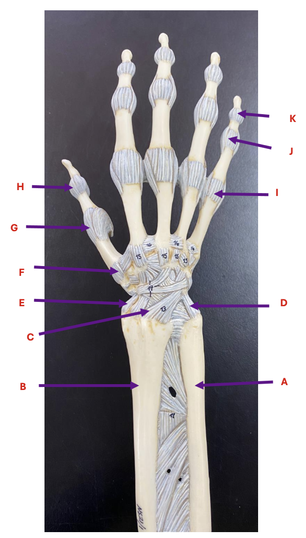 <p>Identify each labelled structure in the image (Hand Posterior View)</p>