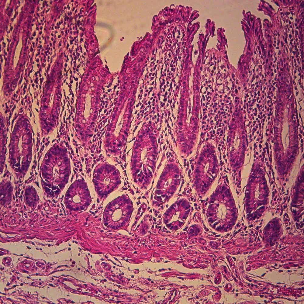 <p>Glandular Epithelium</p>