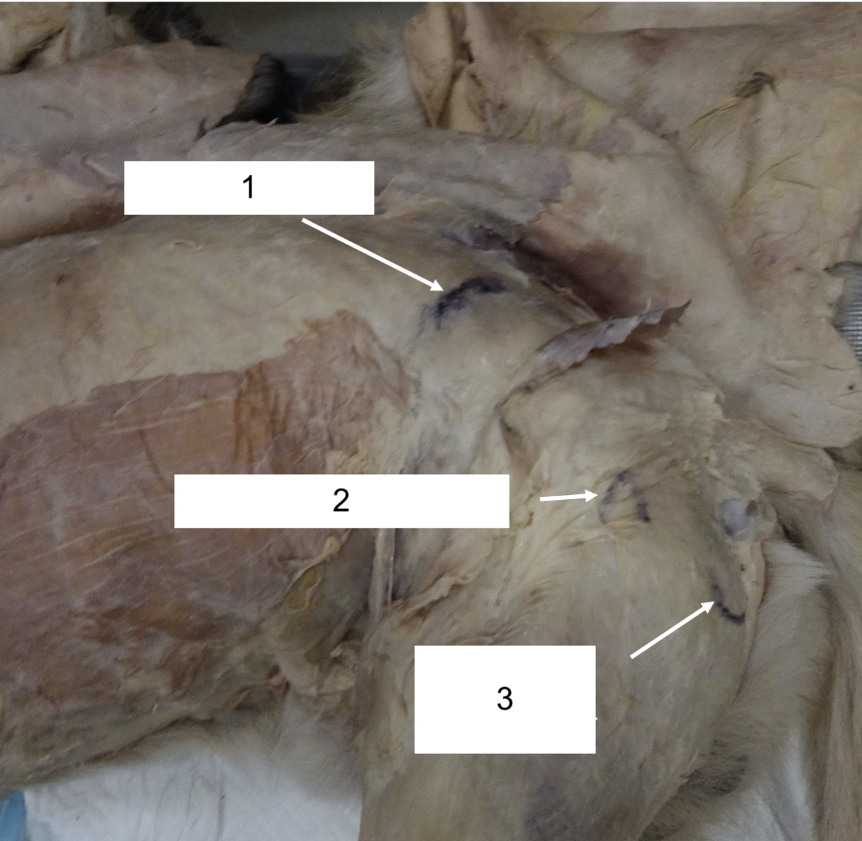 <p>What part of a bone is 3?</p>