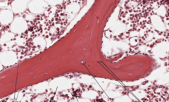 <p>tissue type</p>