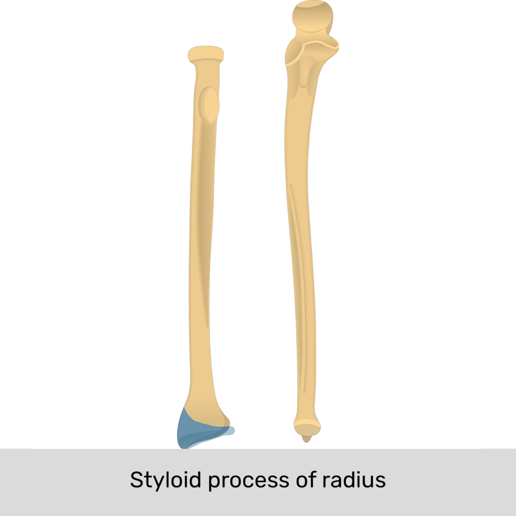 <p>Styloid Process of Radius</p>