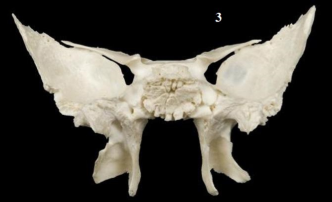 <p>Name This Bone</p>