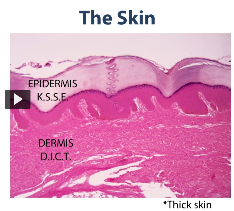 <p>This is an H&E stain section here. Cross section through skin. So you can see that there are various layers.</p><p>This is thick skin and we’ll show you how to differentiate thick skin from thin skin. But for the most part, you can see that there is this large layer of dead cells (epidermis) and there is no nuclei or anything associated with these cells. This is the top layer (epidermis). </p>