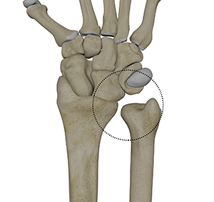 <p>What is this joint?</p>
