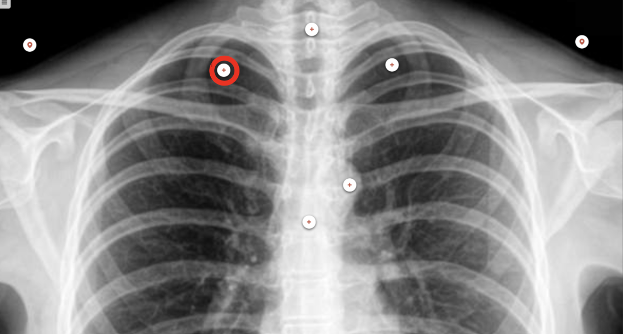 <p>what structure is the red circle labeling?</p>