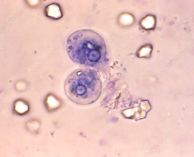 <ol><li><p>Entamoeba moshkovskii</p></li><li><p>Osmotolerant, Survives 0-41 C</p></li><li><p>E. histolytica</p></li></ol><p></p>