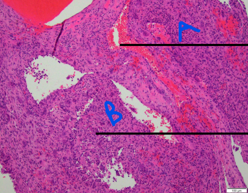term image