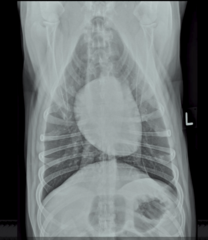 <p>Are these normal or abnormal radiographs?</p>