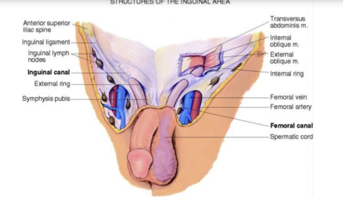 <p>hernia</p>