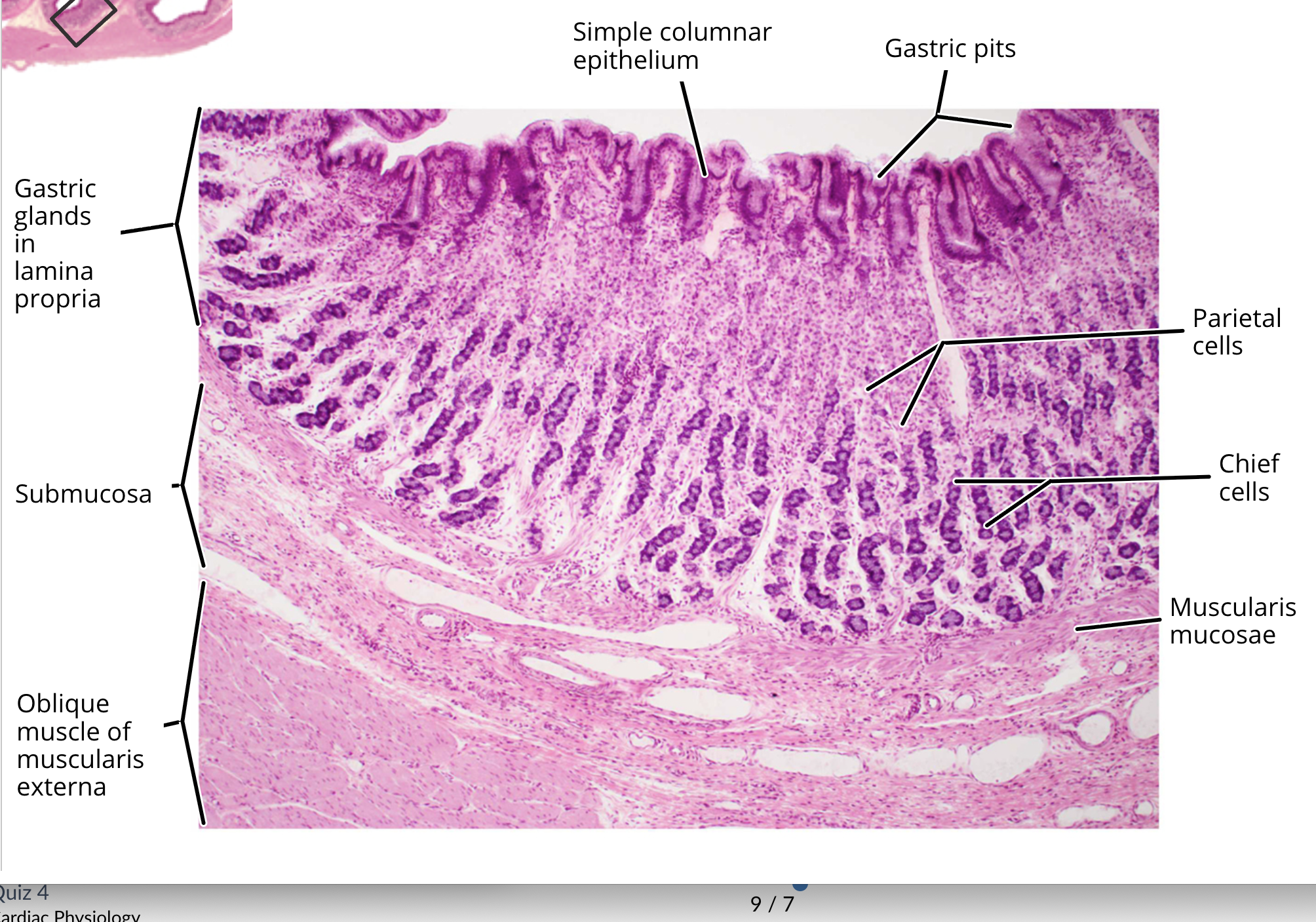 <ul><li><p>mucosa </p></li><li><p>muscularis mucosa </p></li><li><p>submucosa</p></li><li><p>muscularis externa</p></li><li><p>serosa </p></li><li><p><strong>gastric pit</strong></p></li><li><p><strong>mucous neck cells</strong></p></li><li><p><strong>parietal cells</strong></p></li><li><p><strong>chief cells</strong></p></li></ul><p></p>