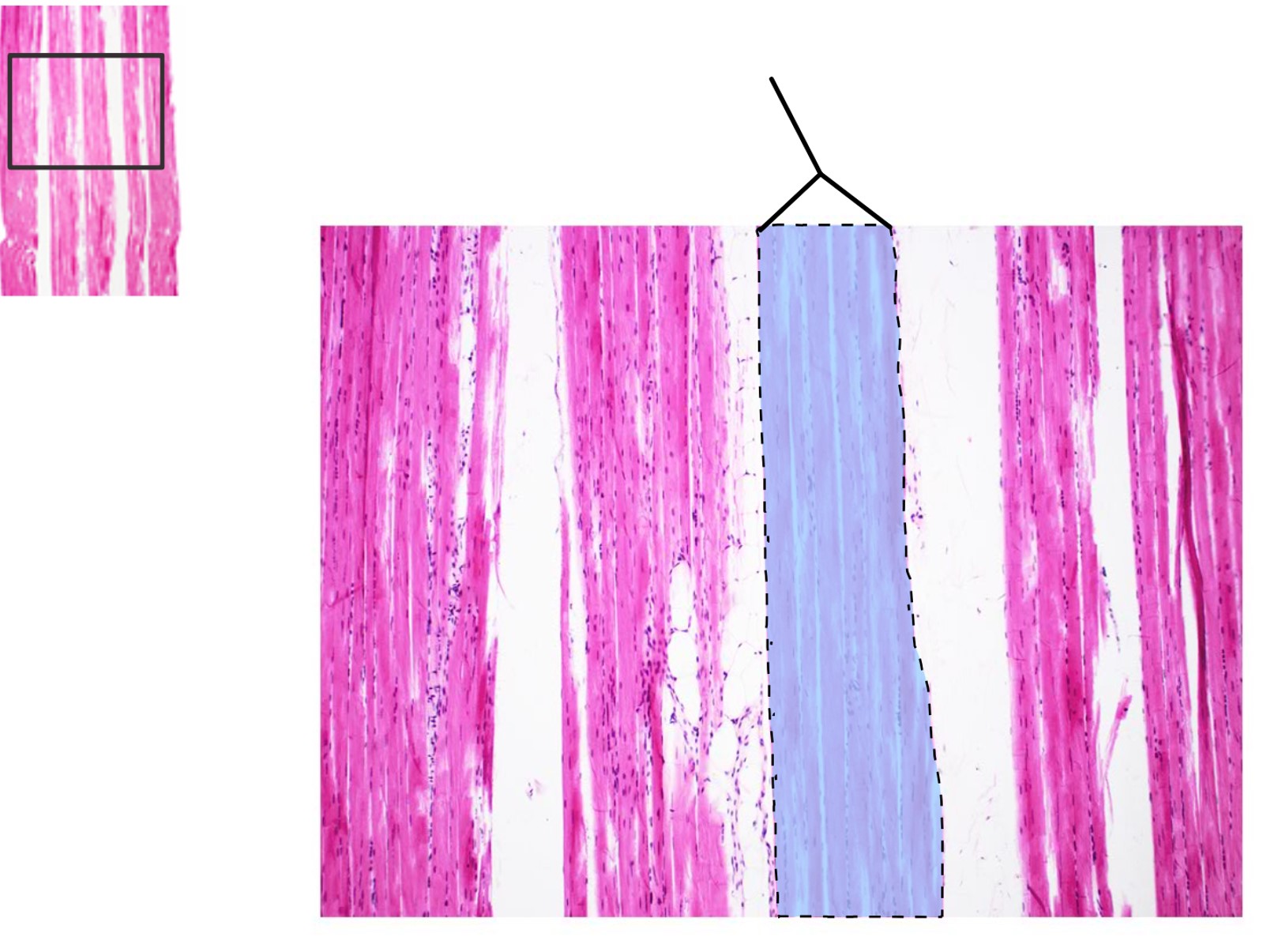 <p><span>What muscle structure is highlighted?</span></p>