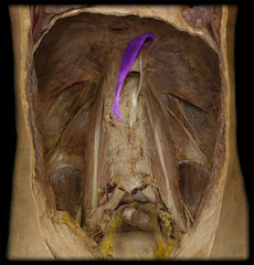 <p>identify the structure</p>