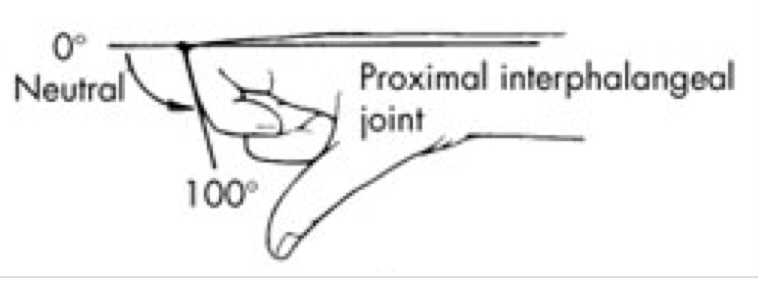 <p>Between proximal and middle phalanx </p><p>Ginglymus (hinge)</p><ul><li><p>Flexion / Extension </p></li></ul><p></p>