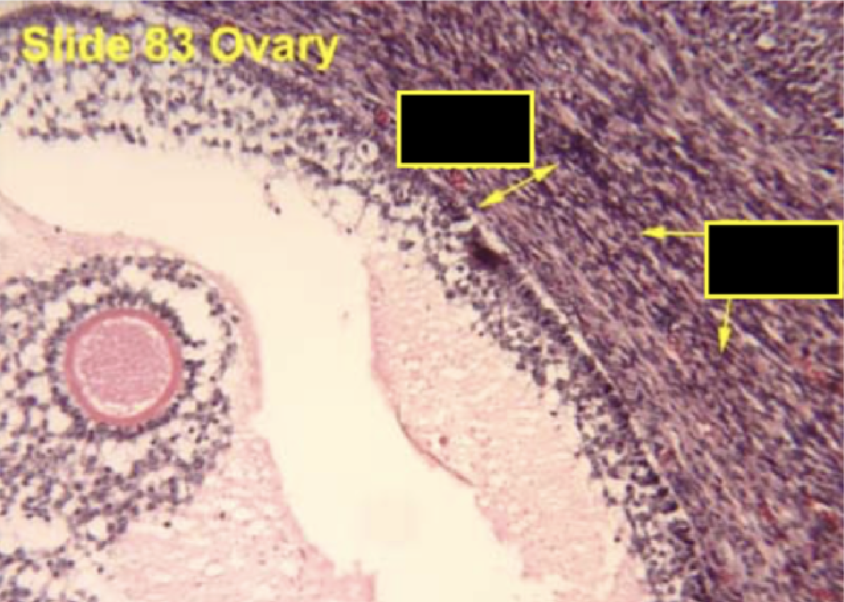 <p>Identify the layer</p>