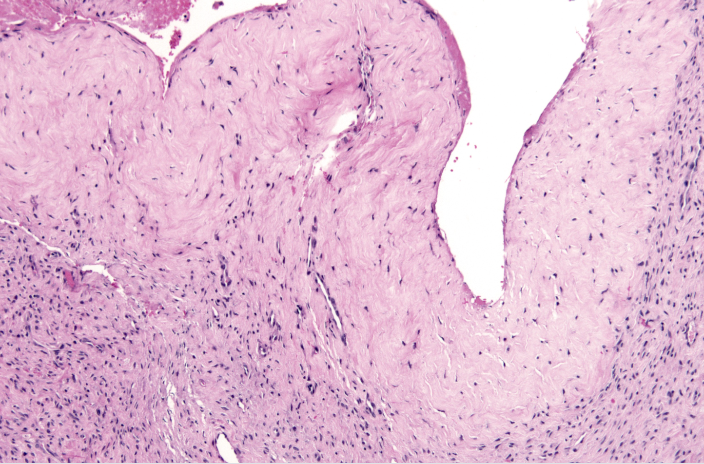 <p>tumeur kystique tibia antérieur enfant de 10 ans</p><p>diagnostic</p><p>définition</p><p>age</p><p>topographie</p><p>anatomie</p><p>histologie</p><p></p>