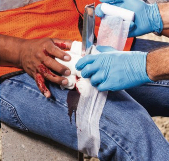 <p>What bandaging technique should be used for this injury?</p>